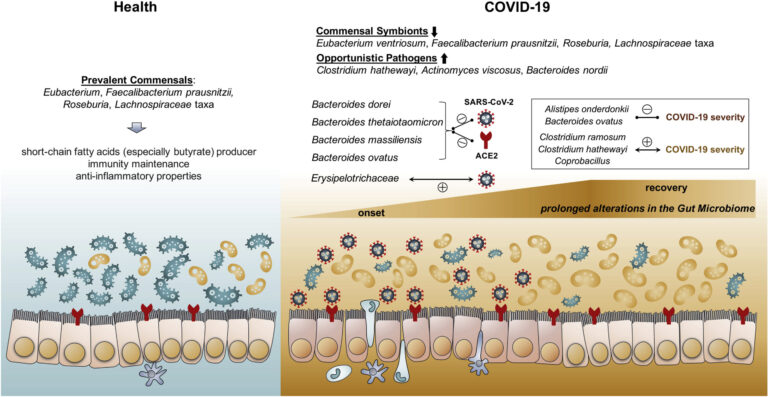 Alterations in Gut Microbiota of Patients With COVID-19, showing how the virus moves through the intestinal walls into the bloodstream.