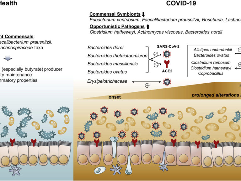 Alterations in Gut Microbiota of Patients With COVID-19, showing how the virus moves through the intestinal walls into the bloodstream.